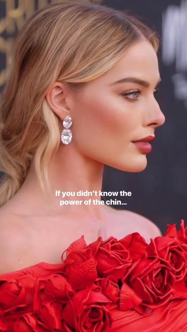 The chin plays such an important role in creating facial balance and harmony, which is why we’re seeing such an increase in requests for chin filler at Surgicare.
Chin filler can:
✨ Enhance projection for a stronger profile
📸 Improve your side profile definition
⚖️ Create better balance between the nose, lips and jawline
đź’Ž Elongate and slim the lower face
🤍 Soften the appearance of a weak or recessed chin
Of course, examples shown here are intentionally exaggerated to demonstrate the impact, but they show why the chin can be such a transformative area to treat.
#LondonAesthetics #ChinFiller #FacialFiller #DermalFillers #London