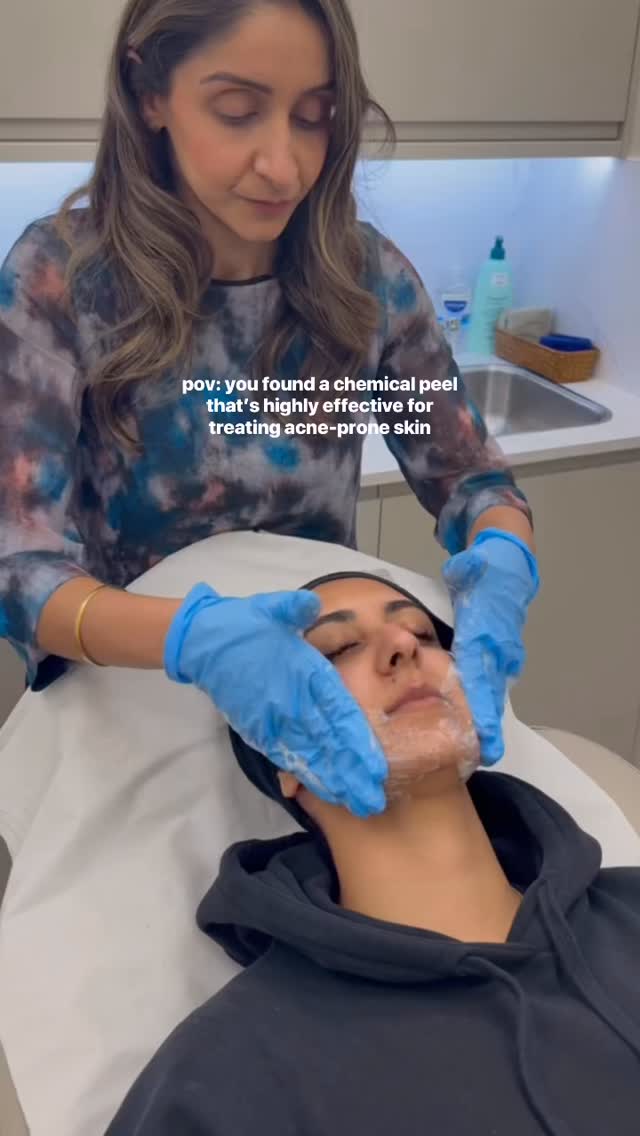 Struggling with breakouts, oily skin or stubborn acne scars? It might be time for a reset. ✨
The Obagi Blue Peel Radiance is a powerful yet gentle treatment designed to deeply exfoliate, unclog pores and refresh your skin in just 30 minutes.
Using a blend of salicylic, lactic and glycolic acids, it works to smooth texture, reduce blemishes and reveal a brighter, clearer complexion.
💧 Helps reduce active acne & breakouts
💧 Improves the appearance of acne scars
💧 Leaves skin feeling smoother, tighter & more radiant
💧 Minimal downtime
Suitable for all skin types! It’s our go-to for clearer, healthier-looking skin without the wait.