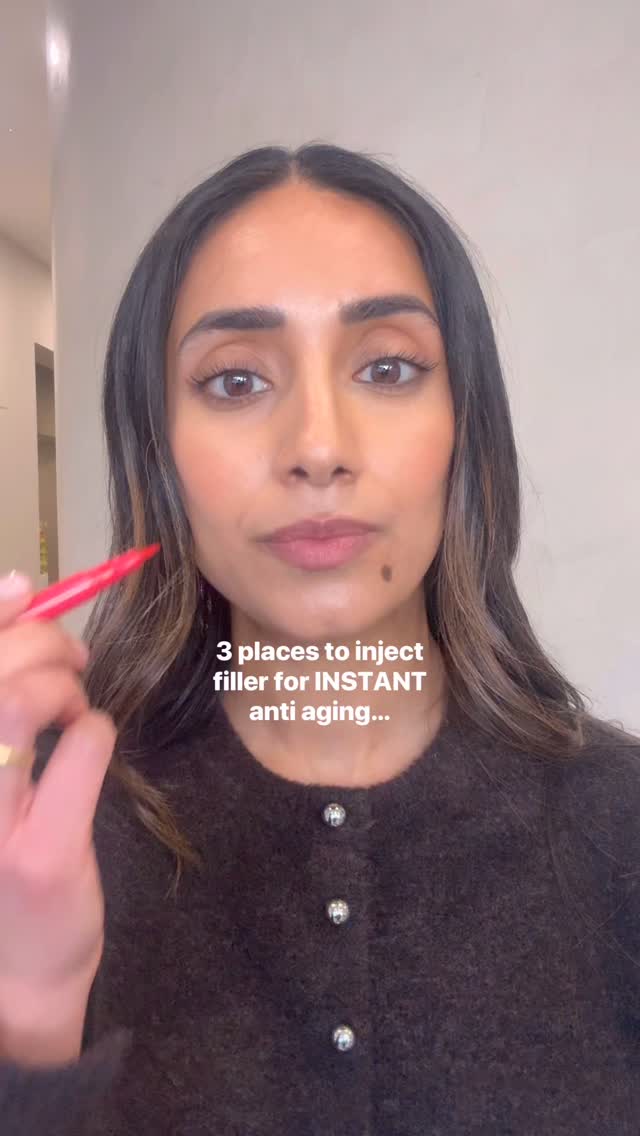 3 areas where filler can be placed for instant anti-ageing 💉✨
Of course, every face is unique, which is why we always recommend a consultation first to find the best approach tailored to you. 🤍
#DermalFillers #FacialAesthetics #Injectables #NorthLondon #FYP