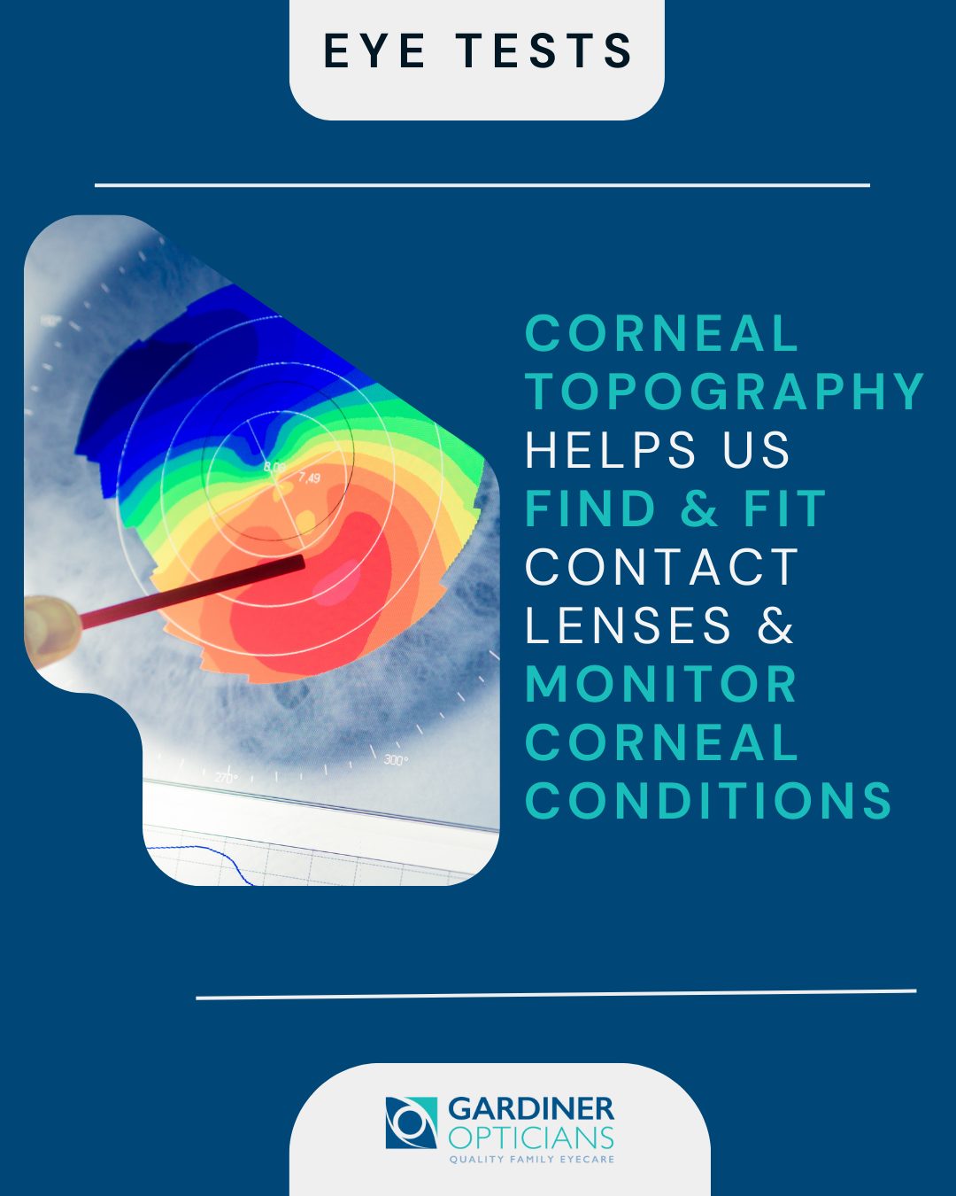 Corneal topography is an advanced, computer-guided test that produces a detailed 3D map of your cornea, showing its shape and curvature.
We use this scan to choose the most suitable contact lenses for you, including lenses for astigmatism and more complex prescriptions, as well as to help detect, monitor and manage corneal conditions.
To book an appointment, please call 01444 248277 or email info@gardineropticians.co.uk.