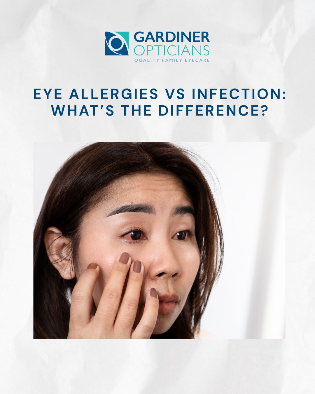 Not sure if it’s allergies or an infection? Here are a few clues:
More likely allergies:
• Itching is the main symptom
• Watery eyes and sneezing
• Both eyes usually affected
• Symptoms come and go (often seasonal)
More likely infection:
• Sticky discharge or crusty lashes (especially on waking)
• One eye starts first and may spread
• Redness that worsens, soreness, or swelling
• Gritty feeling with persistent irritation
If you’re in pain, sensitive to light, your vision changes, or symptoms aren’t improving, it’s best to get proper advice. Call or DM us and we’ll point you in the right direction.
#EyeAllergies #EyeHealth #Opticians #FamilyCare