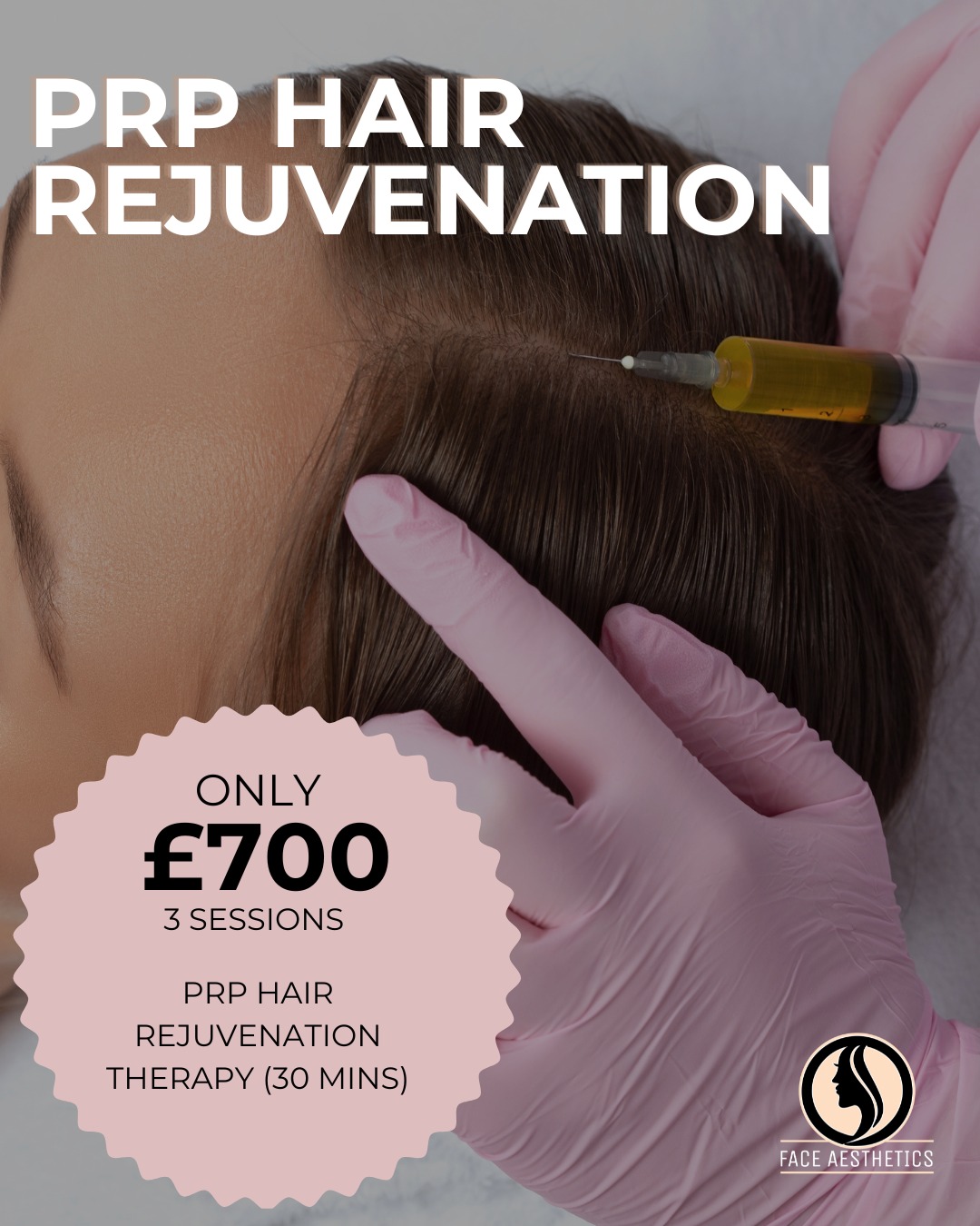 PRP hair rejuvenation therapy is one of our most requested treatments, especially if you’re noticing thinning, shedding, or reduced density.
PRP hair rejuvenation therapy (30 mins)
• 3 treatment sessions: £700
PRP supports scalp health and works best when planned as a course, with your treatment schedule tailored to your consultation and hair goals.
DM “hair” for a suitability check and recommended plan.
Tell me leicester or harley street and I’ll send booking details.
#faceaestheticsuk #prphair #hairtreatment #leicesteraesthetics