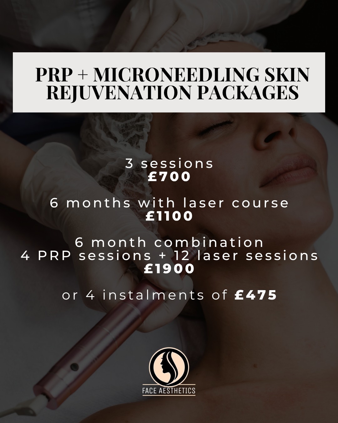 If you’re serious about long-term skin quality, this is one of our strongest plans.
plasma rich platelet and microneedling treatment for skin rejuvenation (30 minutes)
Course options:
• 3 sessions £700
• 6 months with laser course £1100
• combination over 6 months: 4 sessions of prp (every 4 weeks) + 12 sessions of laser — £1900
Also available to pay in 4 instalments of £475.
This package includes 8 target areas, customised to your consultation. Treatment combinations may include areas such as tear trough, cheeks, chin and jawline contouring, lips, and nasolabial folds (depending on suitability).
DM “package” for a suitability check and to discuss which plan fits your skin goals.
Tell me leicester or harley street to book.
#faceaestheticsuk #prpmicroneedling #skinrejuvenation #leicesteraesthetics